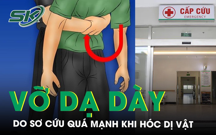Vỡ dạ dày do sơ cứu quá mạnh khi hóc dị vật