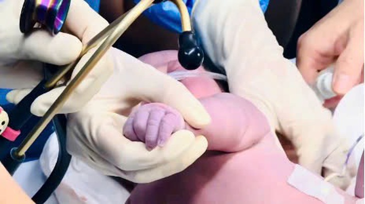 TPHCM can thiệp tim xuyên bào thai thành công cho 2 ca suy tim nặng- Ảnh 3.