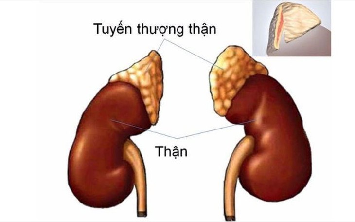 Hội chứng Cushing: Nguyên nhân, biểu hiện, cách điều trị và phòng bệnh