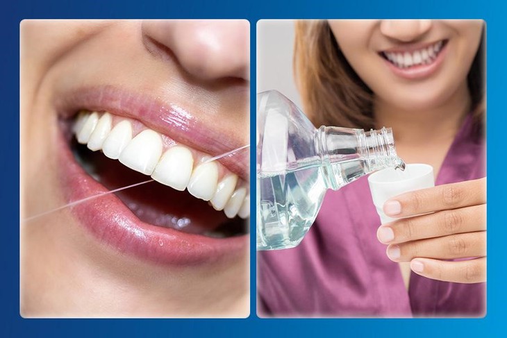 Hướng dẫn cách vệ sinh răng sau khi bọc răng sứ- Ảnh 3.