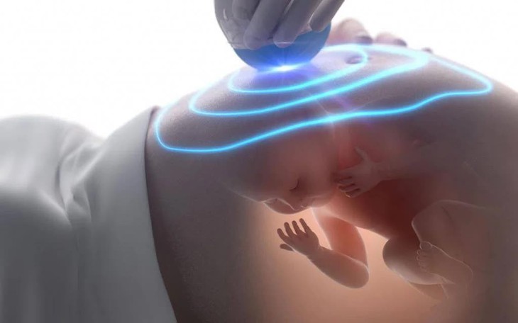 Hội chứng Noonan: Nguyên nhân, biểu hiện, cách điều trị và phòng bệnh