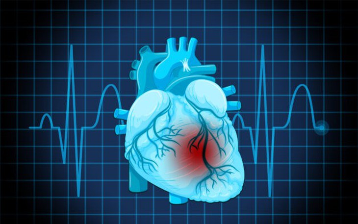 Dấu hiệu cảnh báo rối loạn nhịp tim