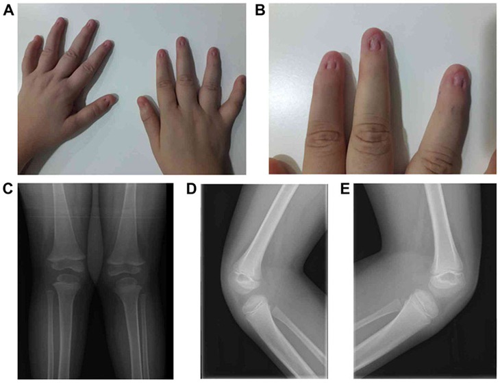 Thuốc trị hội chứng móng và xương bánh chè- Ảnh 1.