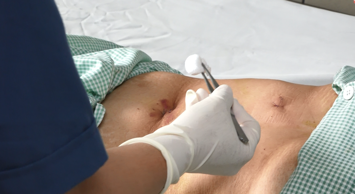Câu hỏi thường gặp về hội chứng quai mù- Ảnh 2.