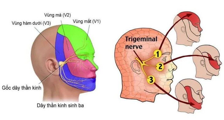 Hội chứng đau nhức vùng sọ mặt: Nguyên nhân, biểu hiện, cách điều trị và phòng bệnh- Ảnh 1.