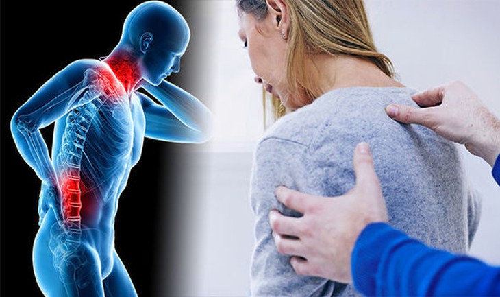 Câu hỏi thường gặp liên quan đến hội chứng Sudeck- Ảnh 1. Câu hỏi thường gặp liên quan đến hội chứng Sudeck- Ảnh 1.
