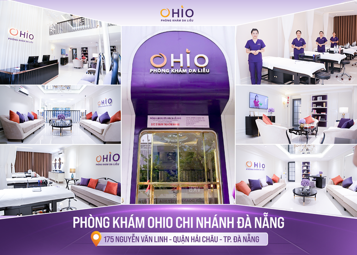 Trị giãn mao mạch uy tín tại Đà Nẵng - Chọn Phòng khám da liễu OHIO- Ảnh 2.