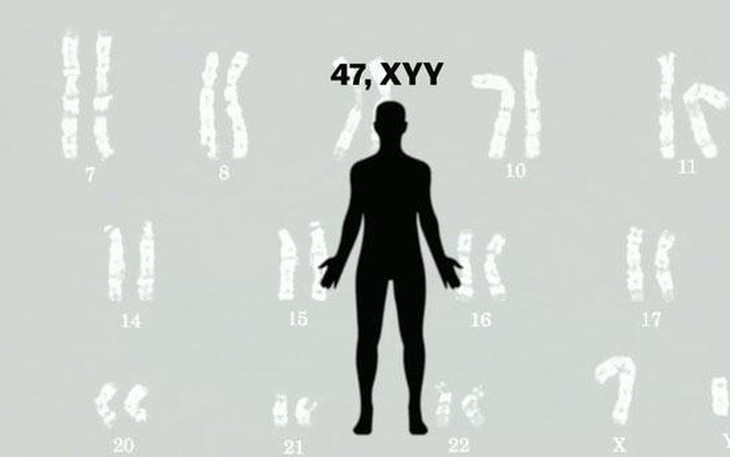 Hội chứng XYY: Nguyên nhân, biểu hiện, cách điều trị và phòng bệnh