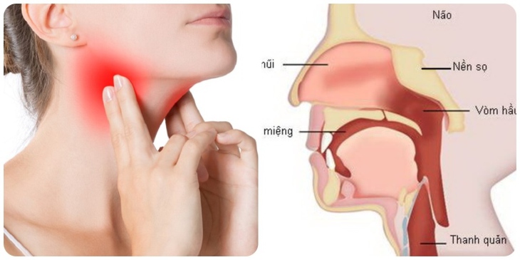 Dấu hiệu ung thư vòm họng ở phụ nữ