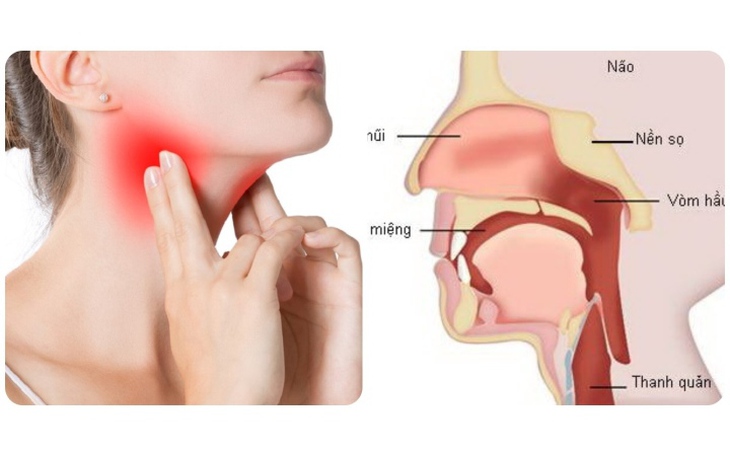 Các yếu tố nguy cơ gây ung thư vòm họng ở phụ nữ 