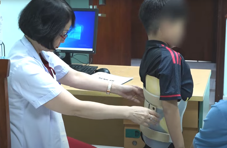 Gù cột sống: Nguyên nhân, triệu chứng, phòng ngừa và điều trị- Ảnh 3.
