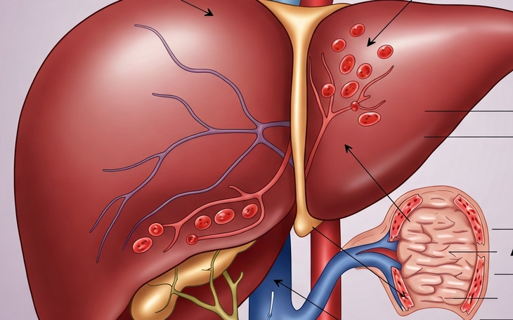 Hội chứng Budd-Chiari: Nguyên nhân, triệu chứng, cách điều trị và dự phòng