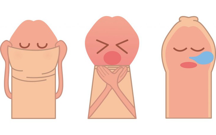 Hẹp bao quy đầu: Nguyên nhân, biểu hiện, cách điều trị và phòng bệnh