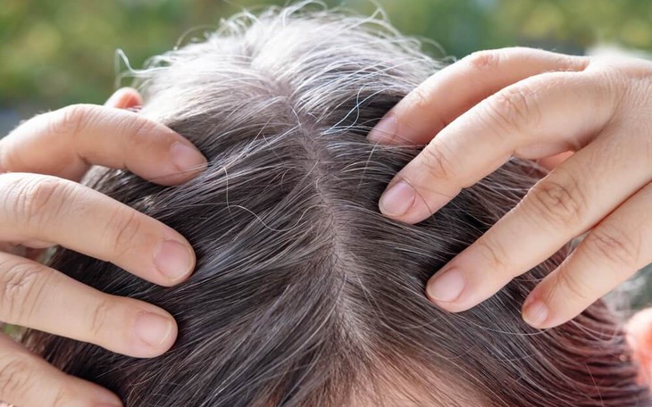 6 thói quen khiến tóc bạc sớm