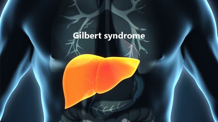 Dinh dưỡng trong hội chứng Gilbert- Ảnh 1.
