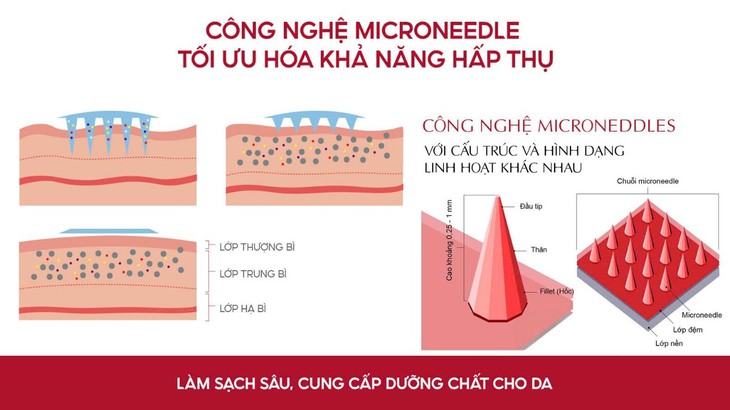 Exosome kết hợp cùng Microneedle - Bước tiến mới trong việc tái tạo và phục hồi da- Ảnh 3.