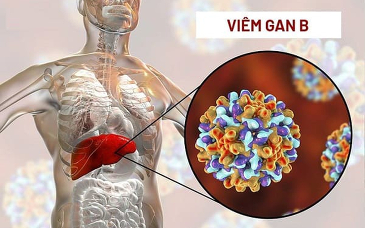 Nguy cơ suy gan nếu tự bỏ thuốc điều trị viêm gan B