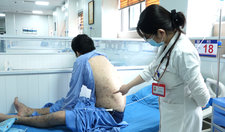 Người lớn bị thủy đậu có được tắm không?- Ảnh 1.