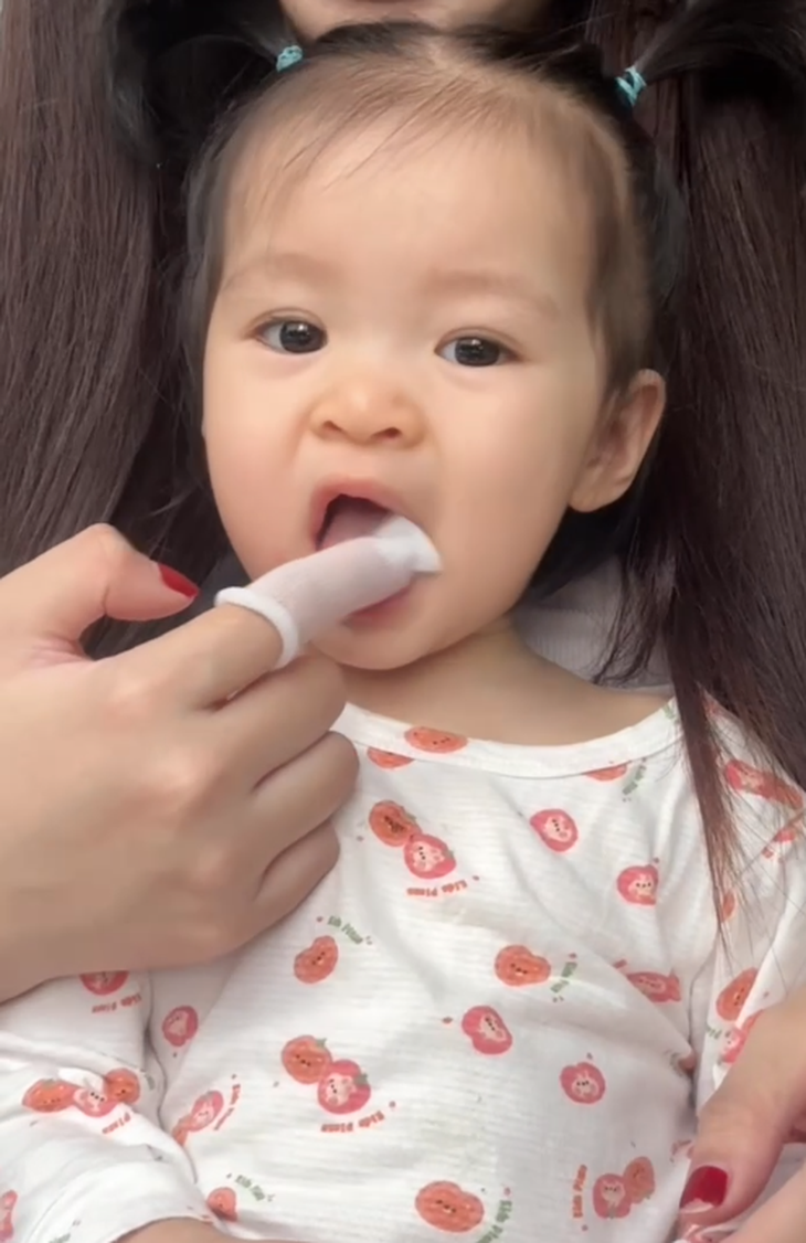 Chỉ vì một hiểu lầm về răng sữa, mẹ vô tình khiến con dễ bị sâu sún răng mà không hay- Ảnh 2.