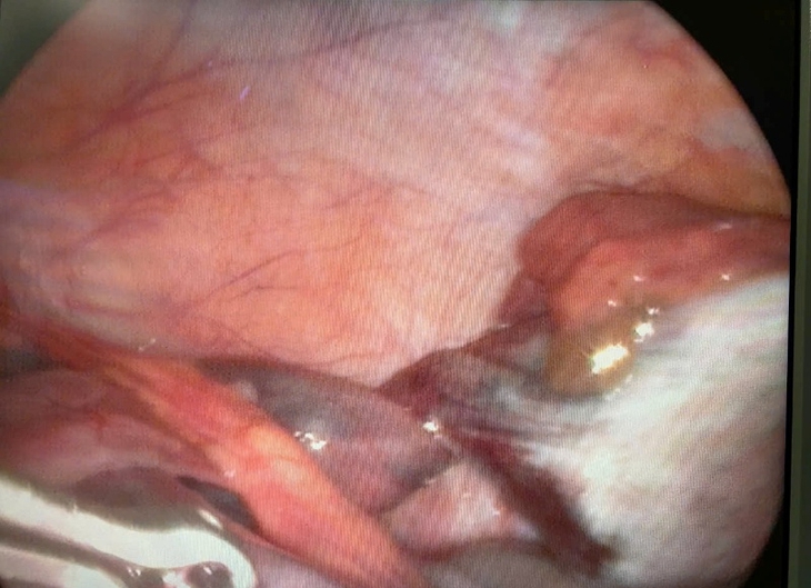 Close-up of a human body  AI-generated content may be incorrect.
