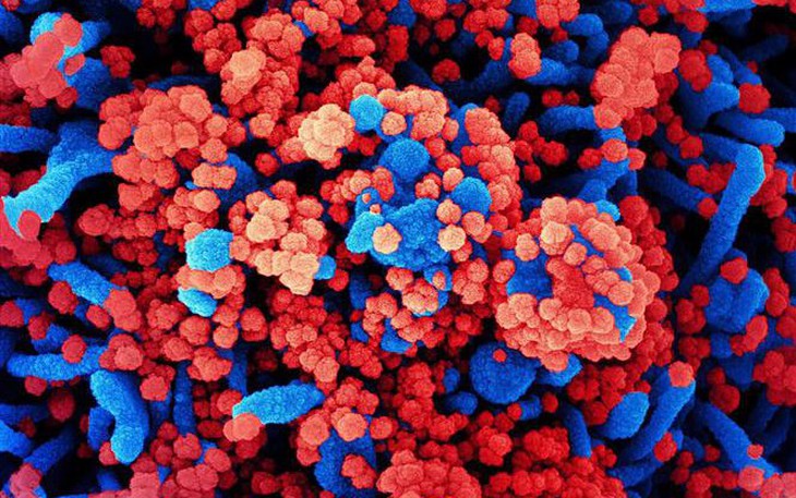 Nga lên tiếng về loại virus chưa xác định gây ra tình trạng ho ra máu