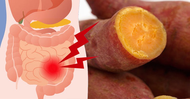 3 nhóm người nên hạn chế ăn khoai lang- Ảnh 1.