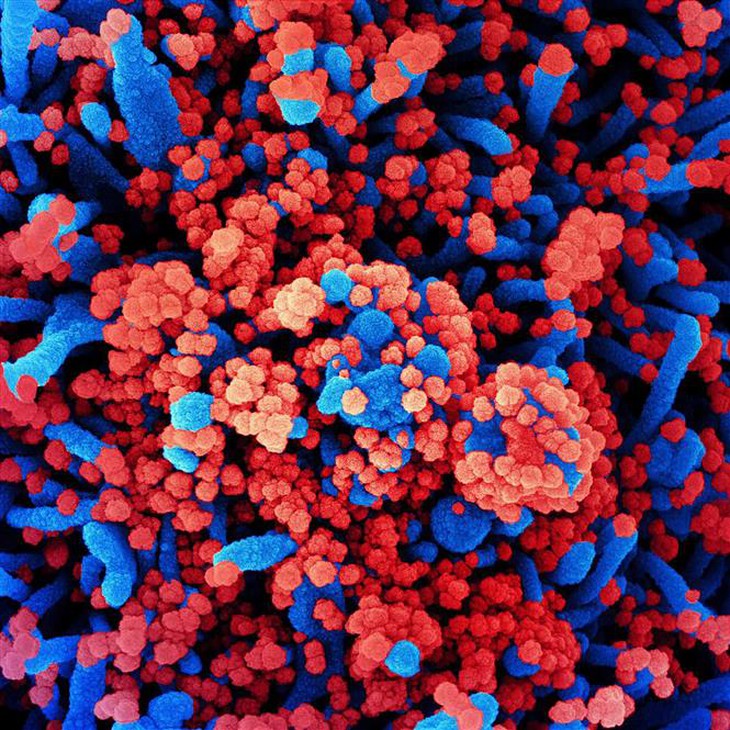 Nga lên tiếng về loại virus chưa xác định gây ra tình trạng ho ra máu- Ảnh 1. Nga lên tiếng về loại virus chưa xác định gây ra tình trạng ho ra máu- Ảnh 1.