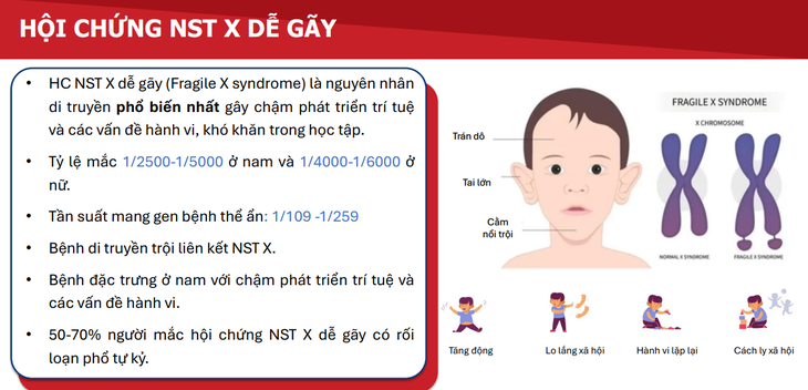 Hội chứng Fragile X – Nguyên nhân di truyền phổ biến gây thiểu năng trí tuệ ở trẻ- Ảnh 1.