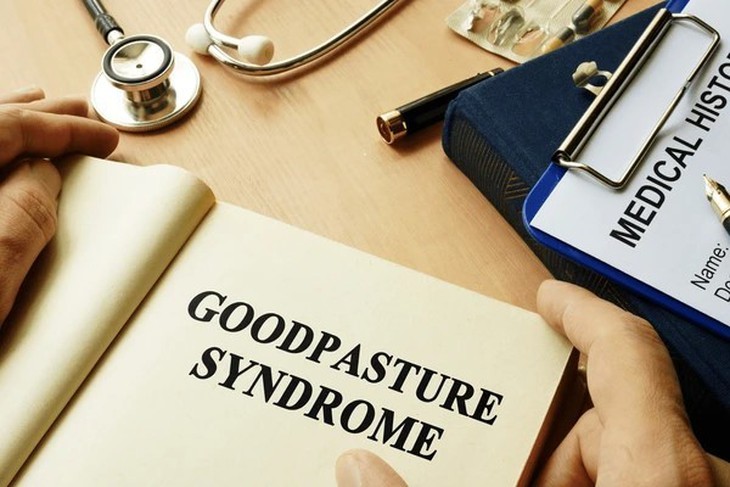 6 câu hỏi thường gặp về hội chứng Goodpasture- Ảnh 1.