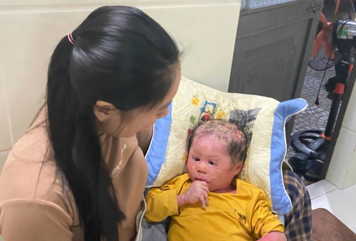 Hơn 13 triệu đồng đến với hoàn cảnh cháu bé da toàn thân bong tróc vì bệnh quái ác- Ảnh 1.