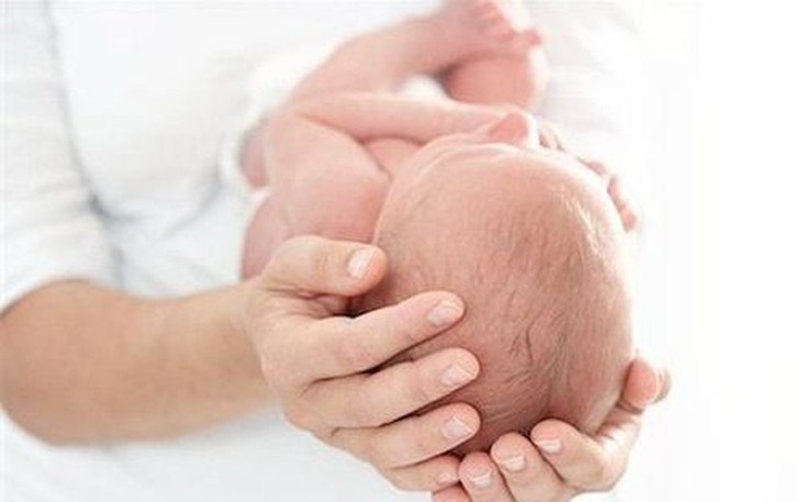 Câu hỏi thường gặp liên quan đến hội chứng Crouzon