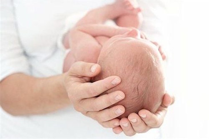 Câu hỏi thường gặp liên quan đến hội chứng Crouzon- Ảnh 1.