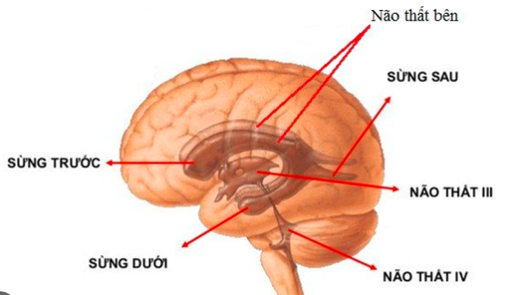 Chế độ ăn tham khảo với người bị giãn não thất- Ảnh 1.