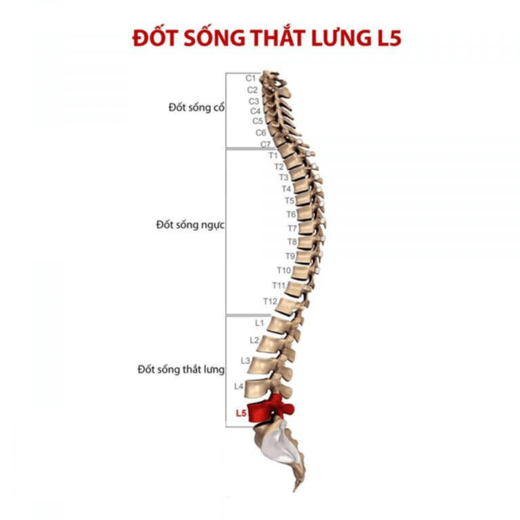 Thoái hóa cột sống thắt lưng: Nguyên nhân, biểu hiện và phương pháp điều trị- Ảnh 1.