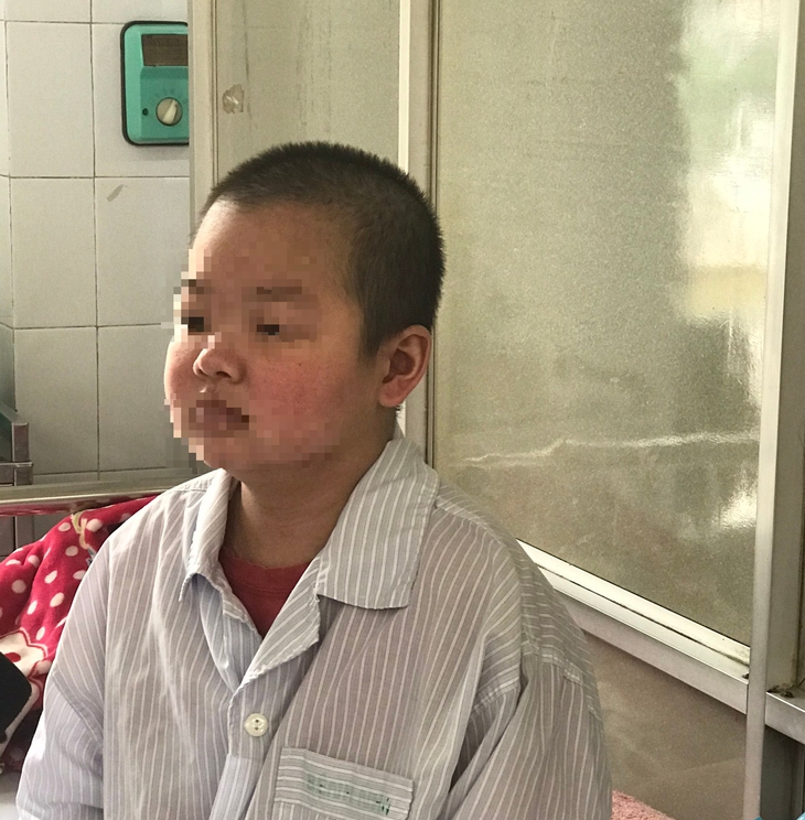 Câu hỏi thường gặp về lupus ban đỏ- Ảnh 2.