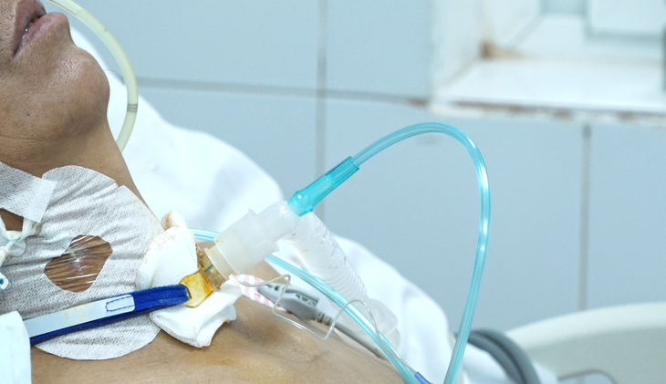 Liệt nửa người: Nguyên nhân, triệu chứng, phòng ngừa và điều trị- Ảnh 2.