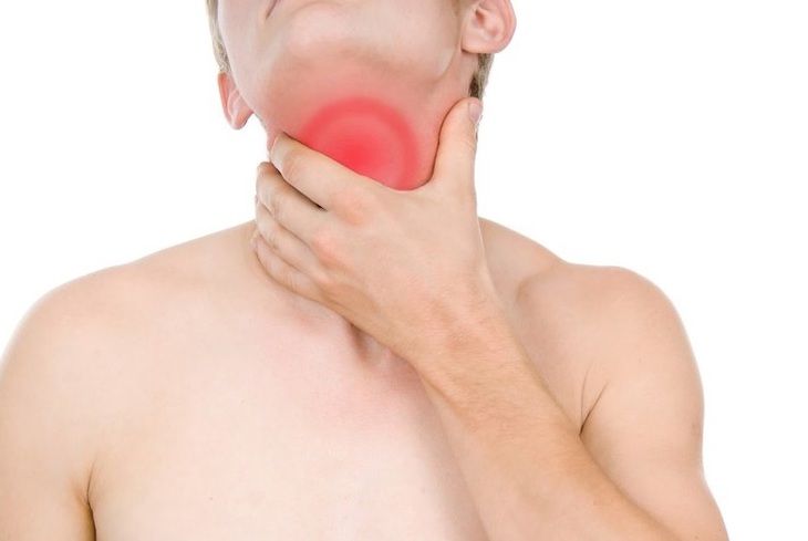 Câu hỏi thường gặp liên quan đến bệnh loét thực quản- Ảnh 3.