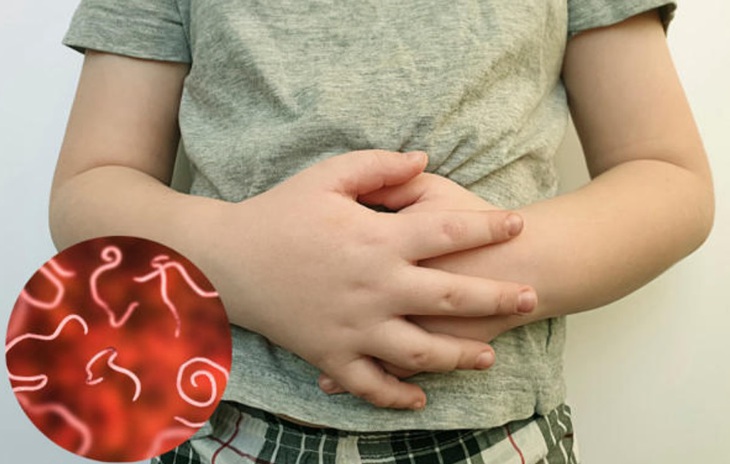 Câu hỏi thường gặp liên quan đến bệnh giun tóc- Ảnh 3.