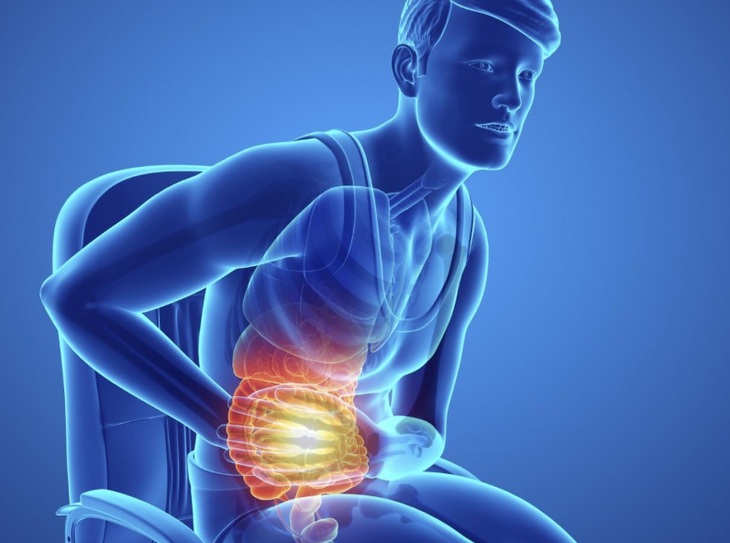 Câu hỏi thường gặp liên quan đến bệnh liệt ruột- Ảnh 3.