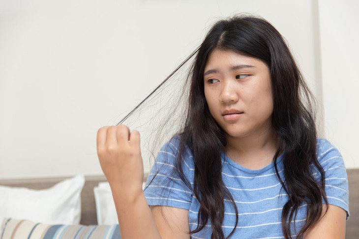 6 câu hỏi thường gặp về hội chứng nghiện giật tóc- Ảnh 1.