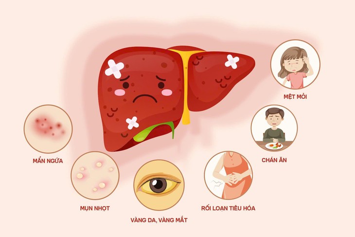 Giải pháp Dinh dưỡng Y học chuyên biệt cho người bệnh gan- Ảnh 1.