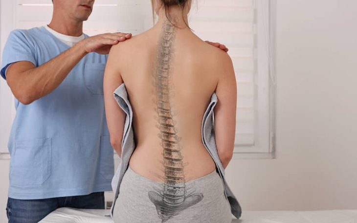Vẹo cột sống: Nguyên nhân, triệu chứng, phòng ngừa và điều trị