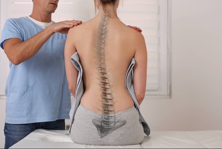 Vẹo cột sống: Nguyên nhân, triệu chứng, phòng ngừa và điều trị- Ảnh 1.