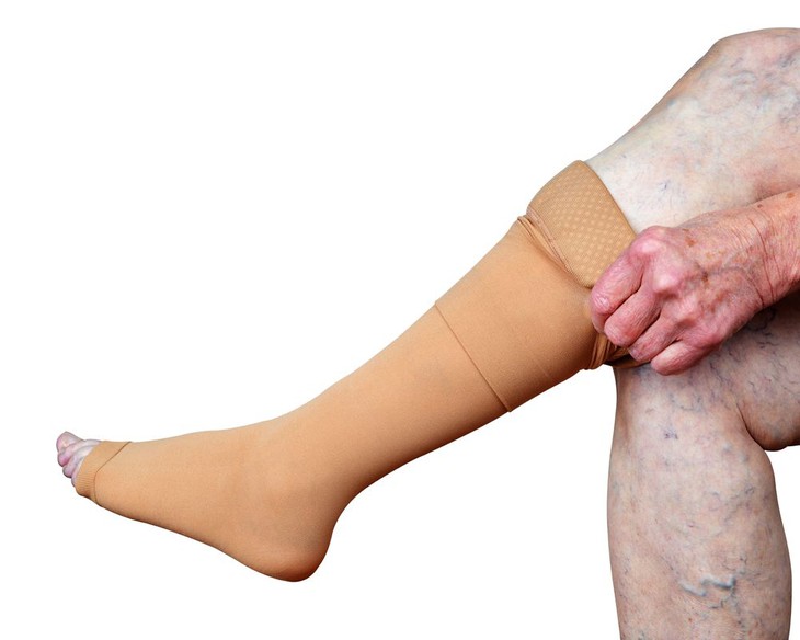 Các thuốc điều trị giãn tĩnh mạch chân- Ảnh 3. Các thuốc điều trị giãn tĩnh mạch chân- Ảnh 3.