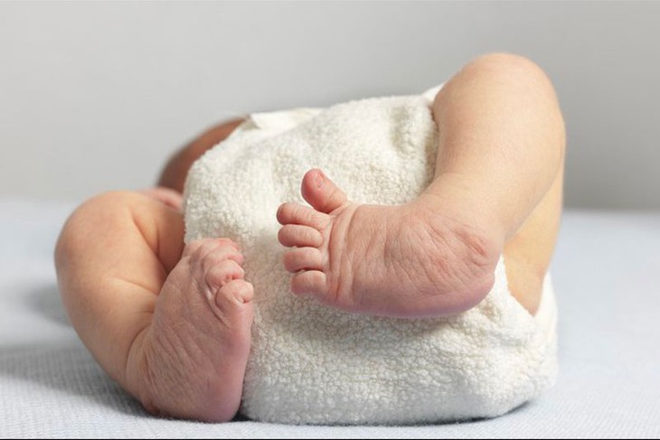 Câu hỏi thường gặp liên quan đến loạn sản sụn xương- Ảnh 1.