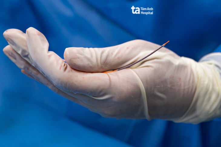 Stent phủ thuốc thế hệ mới giúp kéo dài tuổi thọ cho bệnh nhân tim mạch- Ảnh 1.