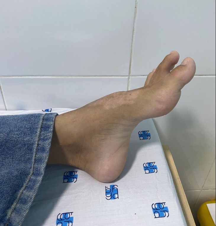 Điều trị kịp thời ca bệnh di truyền hiếm gặp sau nhiều năm bị chẩn đoán nhầm- Ảnh 1. Điều trị kịp thời ca bệnh di truyền hiếm gặp sau nhiều năm bị chẩn đoán nhầm- Ảnh 1.