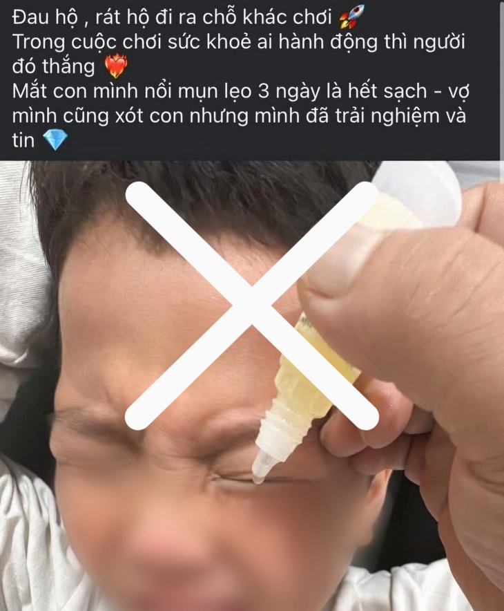 Nhỏ chanh vào mắt có tác dụng như lời đồn?- Ảnh 2.