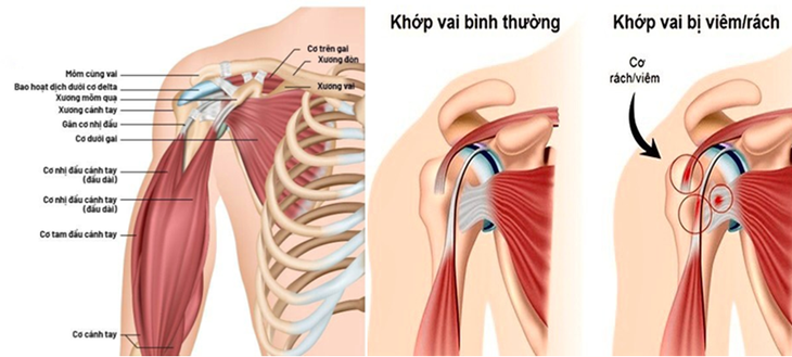 https://trungtamnhietdoivietnga.com.vn/Upload/VienYsinh/xuong-khop.png