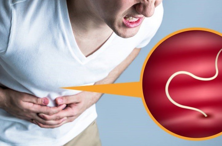 Bệnh giun tóc: Nguyên nhân, biểu hiện, cách điều trị và phòng bệnh- Ảnh 1.